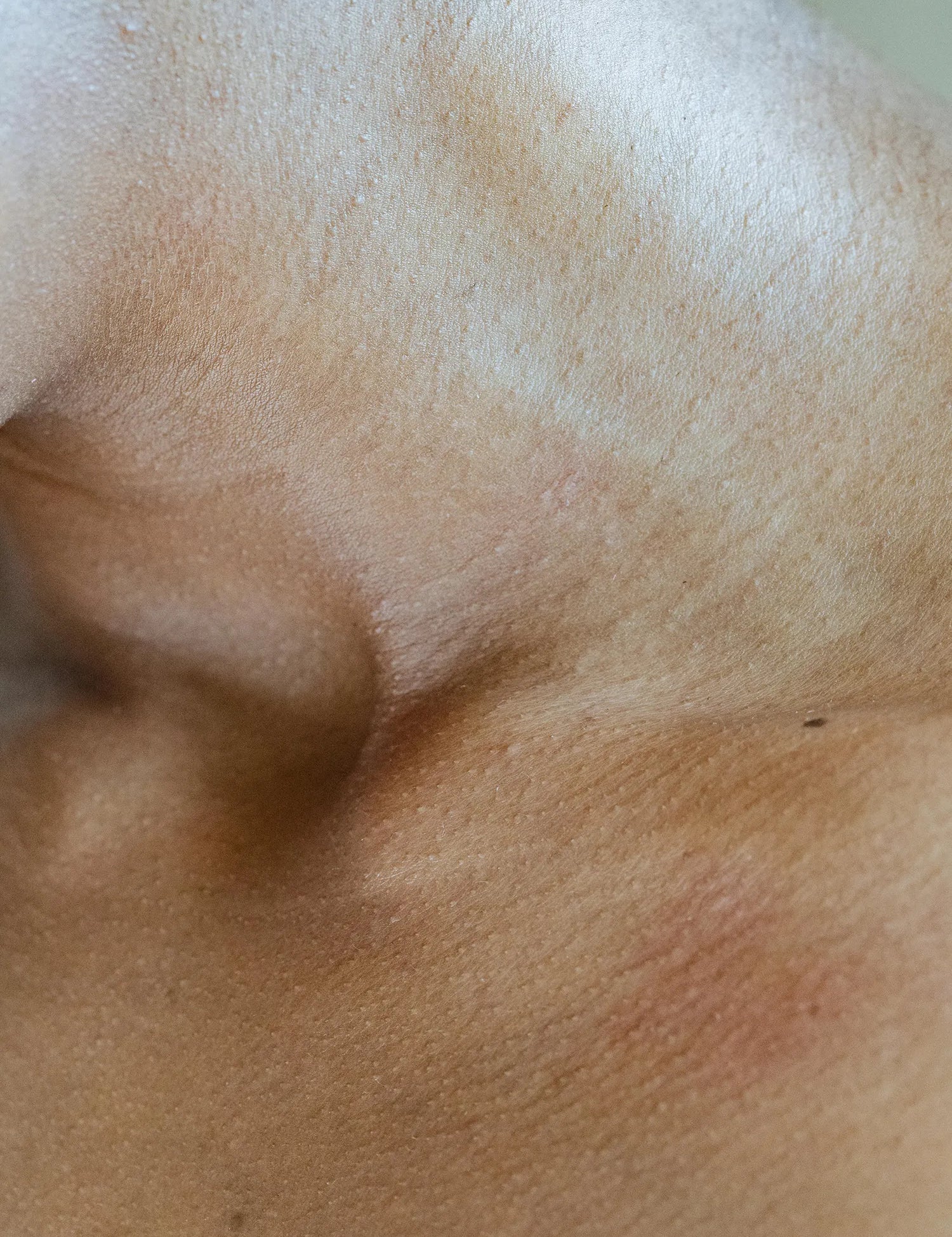 Estrés y piel: por qué tu rostro se inflama y cómo calmarlo