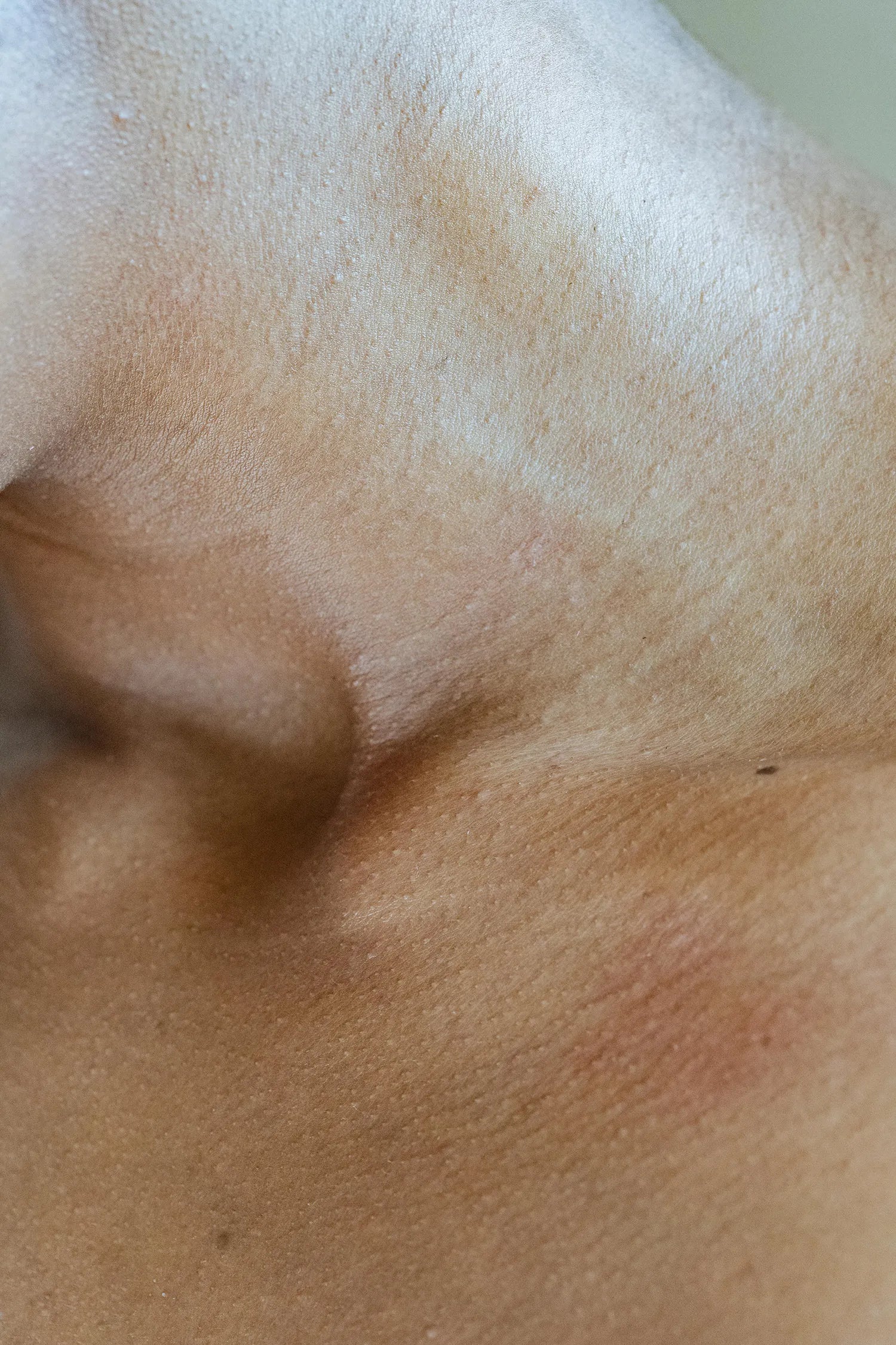 Estrés y piel: por qué tu rostro se inflama y cómo calmarlo
