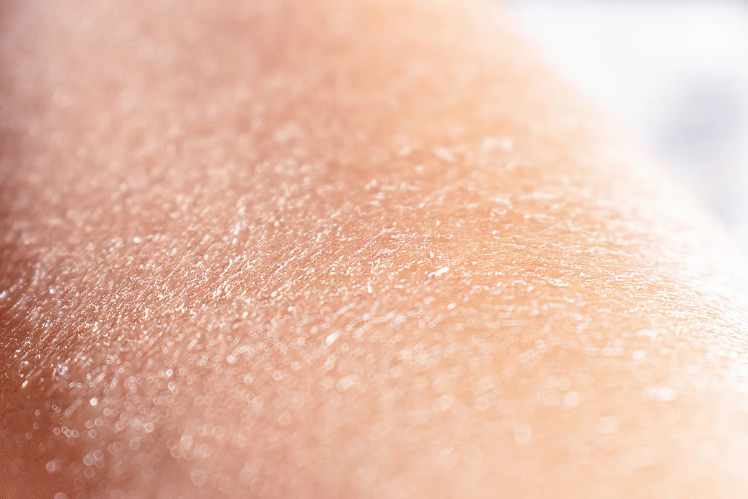 Cómo calmar el picor en la psoriasis: Consejos y tratamientos efectivos