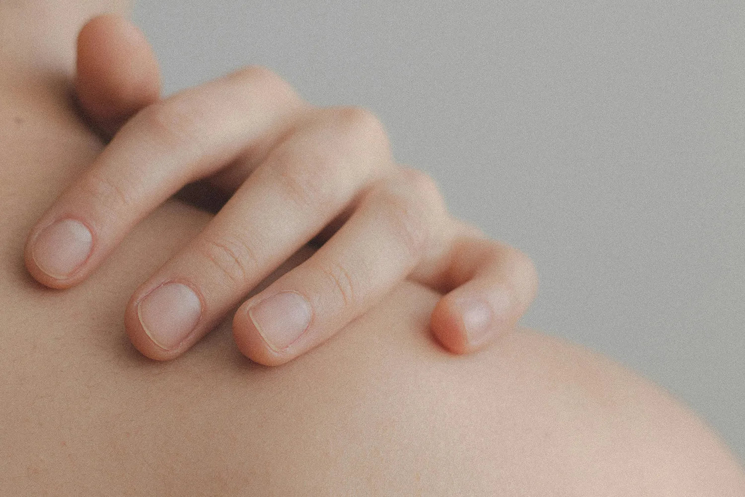 Tratamientos naturales para el eccema: Remedios efectivos para aliviar los síntomas