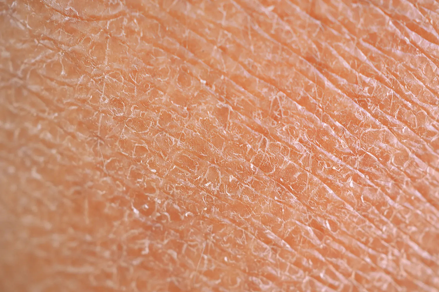 ¿Cómo cuidar la piel seca?: Guía completa para hidratar y proteger tu piel